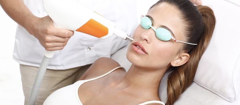 Laser-Hauterneuerung