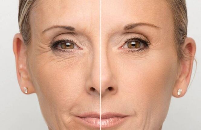 Gesichtshaut vor und nach der Verjüngung mit Masken
